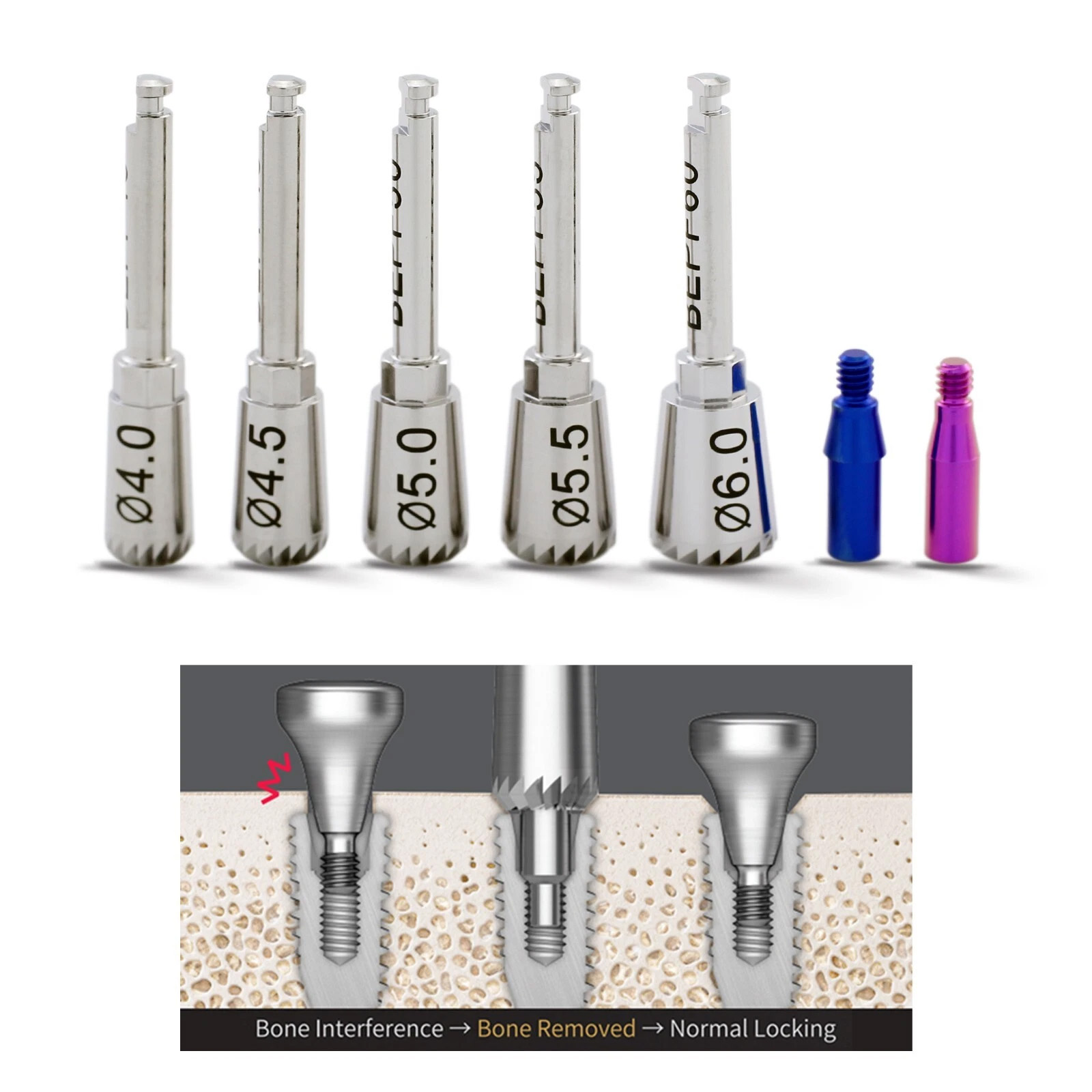 Implantaat ET‑Botprofielmeter met Guide‑schroeven 4.0 / 4.5 / 5.0 / 5.5 / 6.0